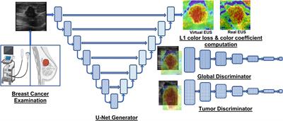 Unveiling the future of breast cancer assessment: a critical review on generative adversarial networks in elastography ultrasound